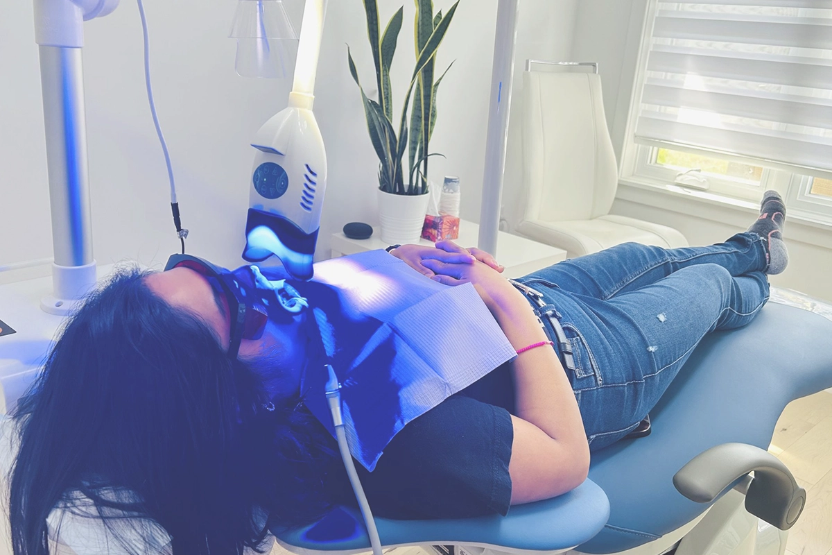 10. Professional Teeth Whitening